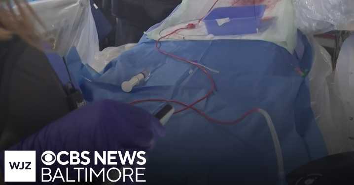 Robots are being tested to lend a hand in stroke surgeries