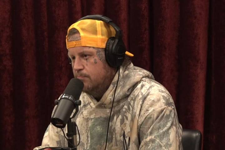 Jelly Roll Says He Doesn't Mind Extra Skin After Weight Loss