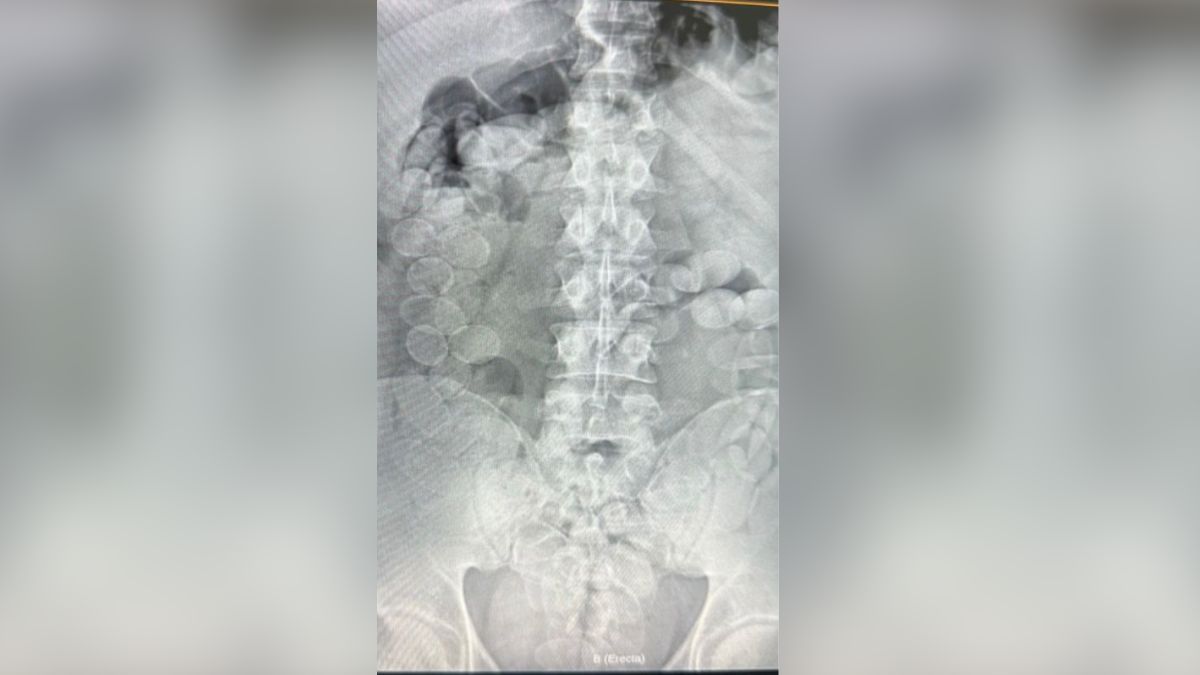 Dos detenidos en la RN 34 con más de 160 cápsulas de cocaína en el organismo