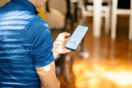 OIG report finds Medicare overpaying for CGMs and supplies