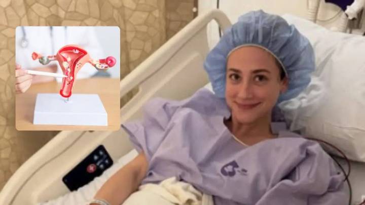 Lili Reinhart’s Endometriosis Diagnosis Brings Attention To Early Warning Signs