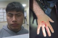 Illegal immigrant bites ICE officer, draws blood while resisting arrest in Tullos, Louisiana