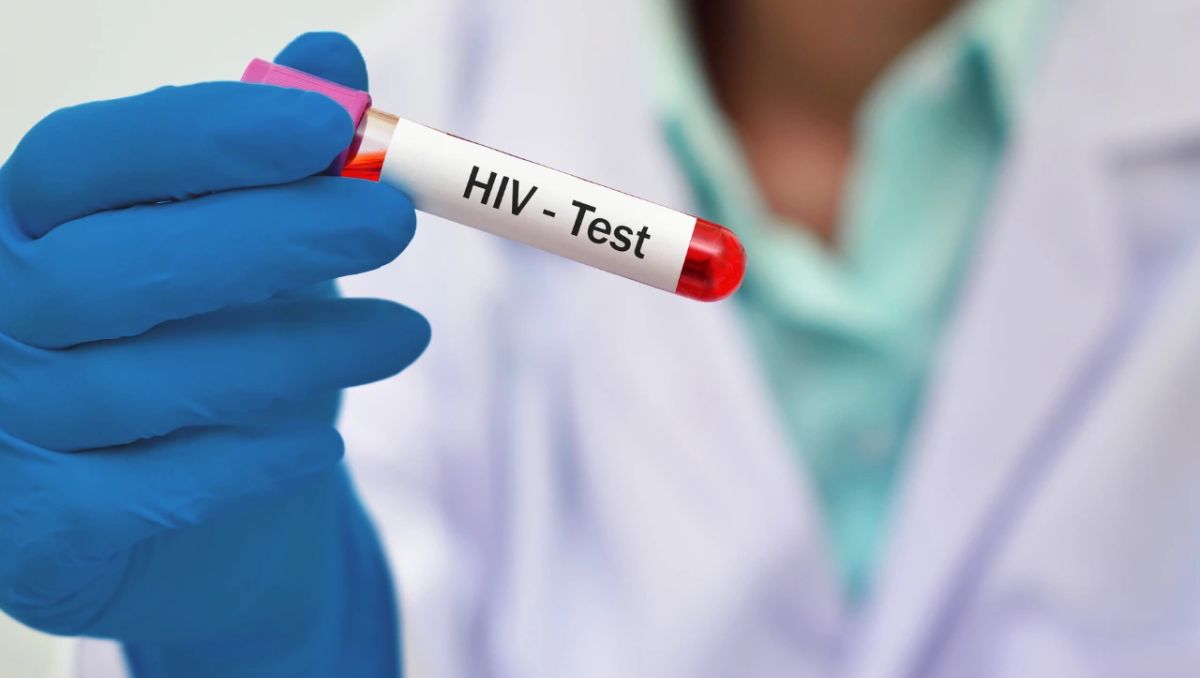 Bajan 18.05% los casos de infección por VIH durante 2025 en Nuevo León