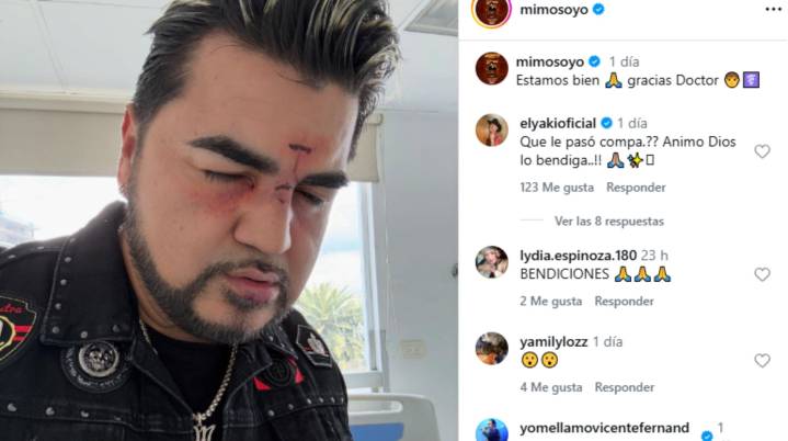 Alarma en el mundo de la Música Regional: 'El Mimoso' aparece con heridas en el rostro y desata especulaciones