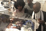 1 in 10 births in the U.S. are premature. Here’s how AI could help doctors predict it