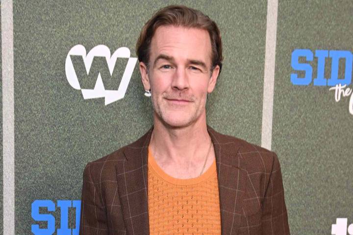 James Van Der Beek Postpones 'Today' Show Appearance Due to Pink Eye