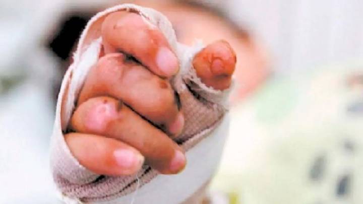 Nariño registra 15 lesionados por pólvora a diciembre 9