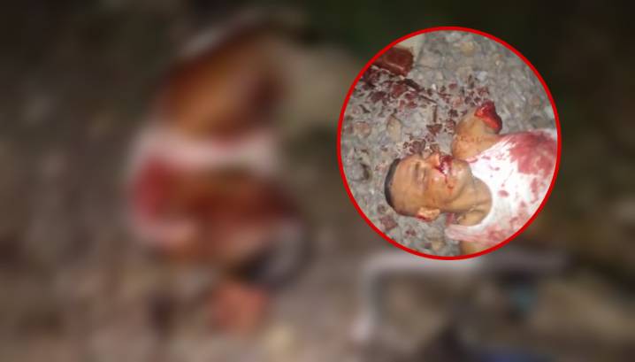 Hombre pierde un brazo al ser arrollado por tren mientras dormía borracho en la vía férrea en Orihueca