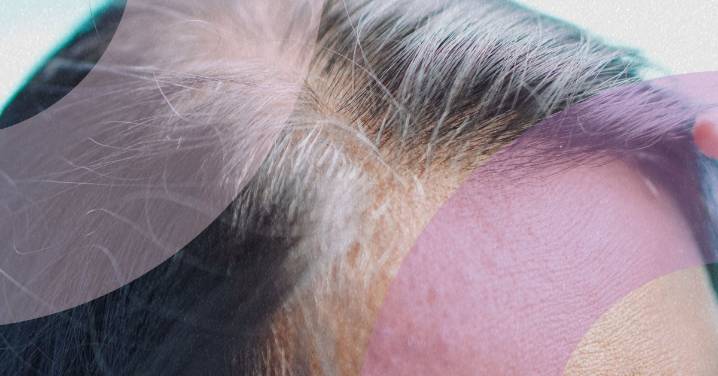 How to Fight Hair Loss During Menopause