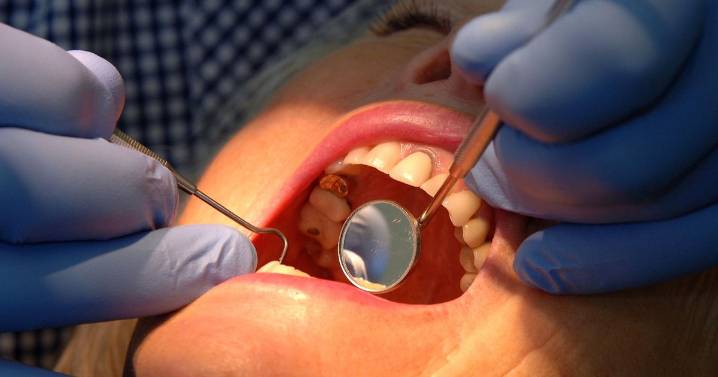 Lack of NHS dentists sees some people ‘pulling their teeth out with pliers’ councillor claims
