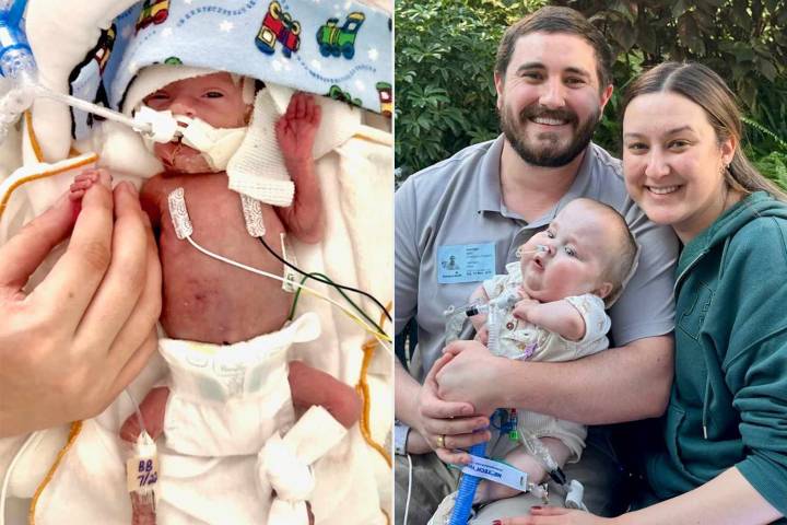 Doctors Told Mom 'Nothing' Could Save Son. He 'Proved Everyone Wrong' (Exclusive)