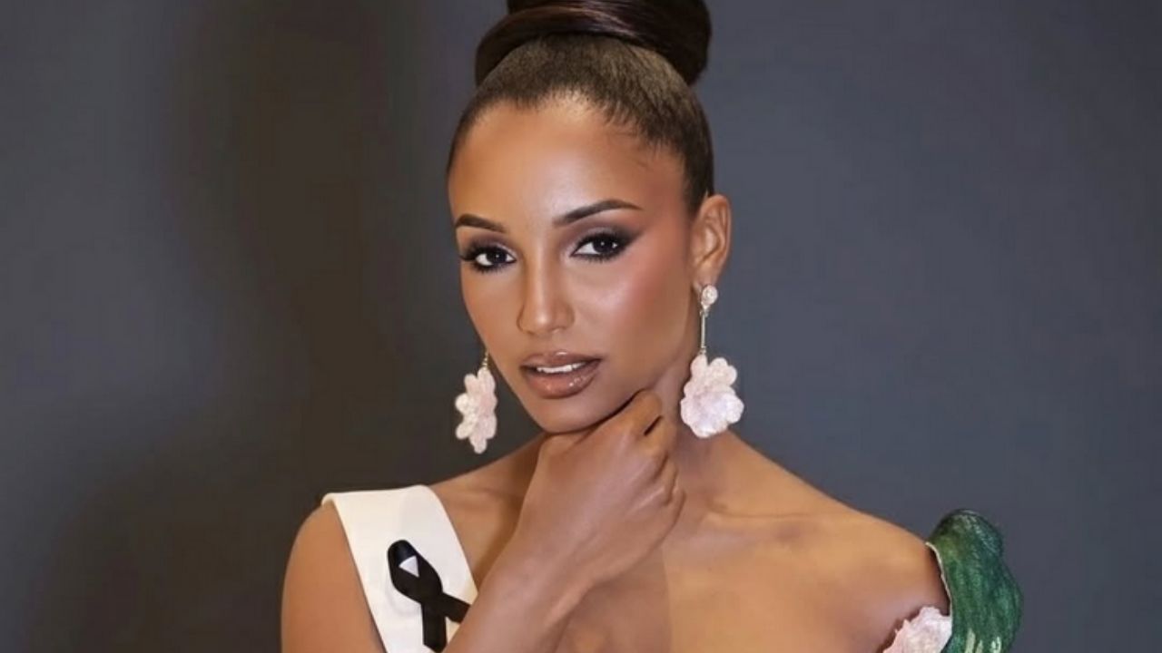 Miss Jamaica sigue hospitalizada tras caída; sufrió una hemorragia intracraneal