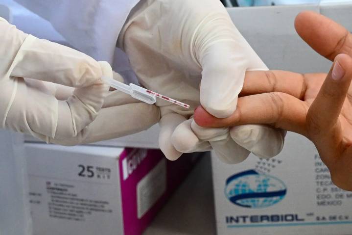 México registro cerca de 15 mil 500 nuevos casos de VIH hasta septiembre de 2025