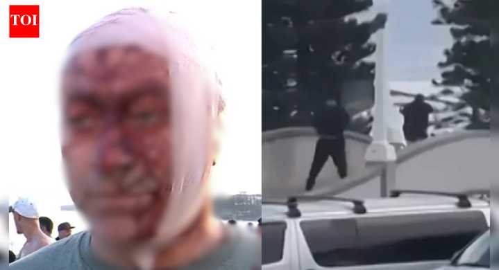 Man who survived October 7 Hamas attack, injured in Bondi Beach shooting, says he ‘never thought he’d see this in Australia’