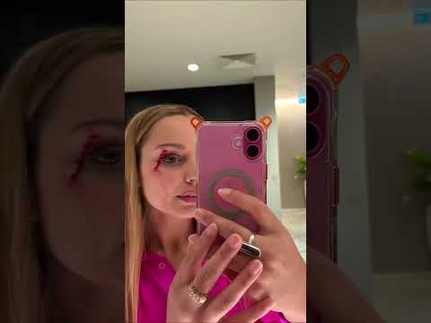 Reporter Whacked in the Face by Bird During On