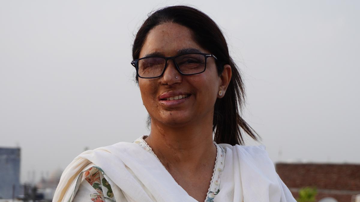 Show no sympathy to acid attackers, entire system must respond against them: CJI