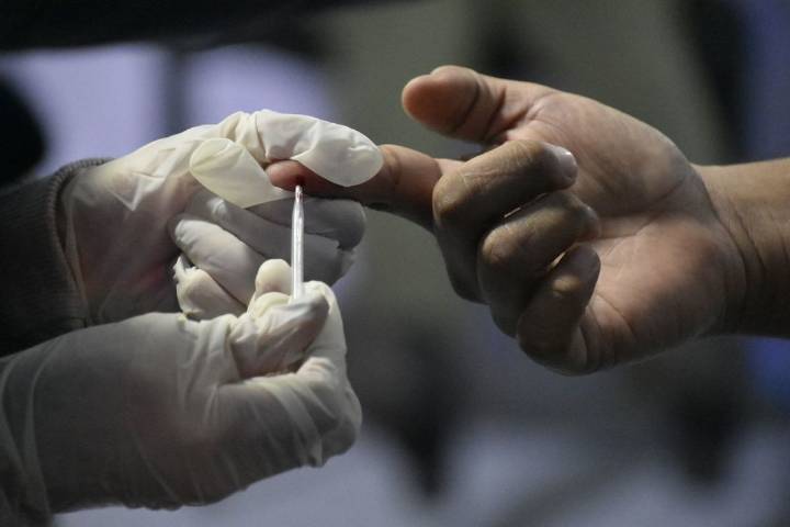 Edomex, la entidad con más casos notificados de VIH