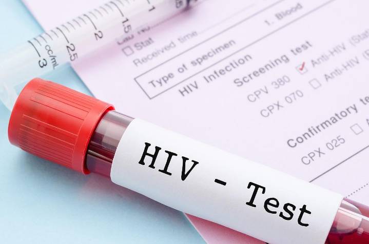 Small Trial Shows Patients Controlled HIV Without Daily Meds For Months
