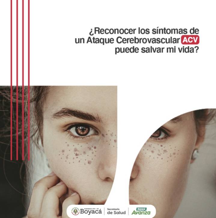 El próximo 29 de octubre es el Día Mundial de la lucha contra el Accidente Cerebrovascular