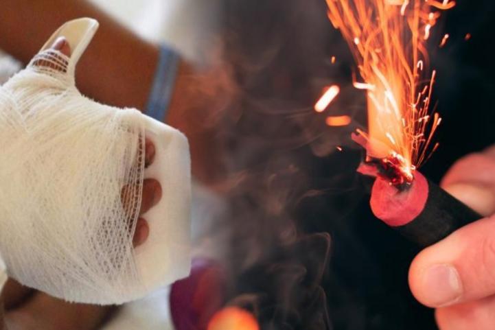 Alarmante aumento de quemados por pólvora: 486 casos en diciembre en Colombia