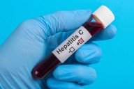 New 15-Minute Test For Hepatitis C Paves Way For Same