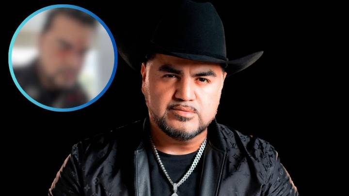 Exvocalista de Banda El Recodo aparece lesionado; ‘El Mimoso’ genera alerta en redes
