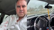 Un candidato presidencial de Perú sobrevive a un atentado tras ser tiroteado en su coche