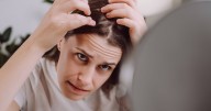 UK women spending hundreds on hair loss treatments as they struggle with self
