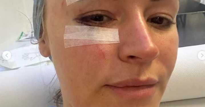 Laura Woods hospitalised in gory horror accident before 'weird' TV collapse