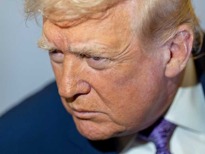 Trump prometió publicar los resultados de su resonancia magnética, aunque admitió no saber qué parte del cuerpo le escanearon