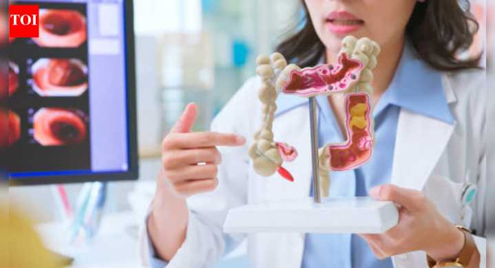 Colon cancer myths that mislead patients, pretend to be harmless, and delay diagnosis