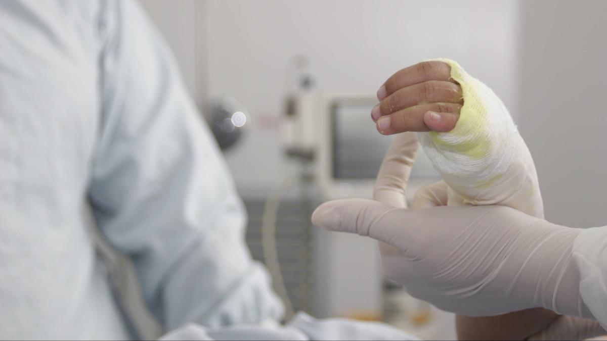 Pólvora en Cali y en el resto del Valle | Alborada, que dio inicio a diciembre, dejó ocho quemados: dos de ellos son menores de edad