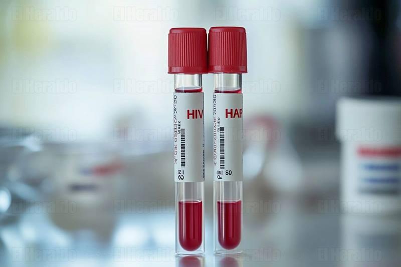 Alertan retroceso en prevención del VIH