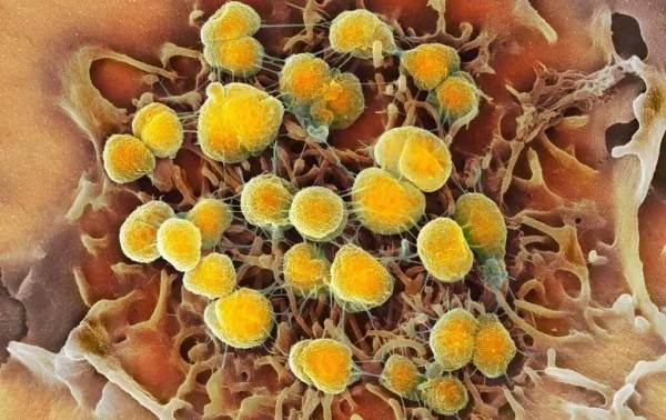 La FDA aprueba dos nuevos medicamentos para tratar la gonorrea