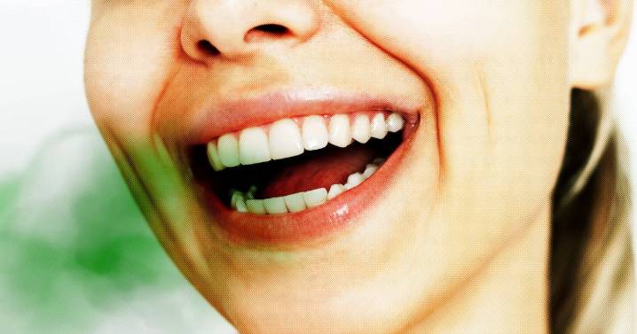 ‘Veneer Breath’ Is Plaguing People With Perfect Smiles