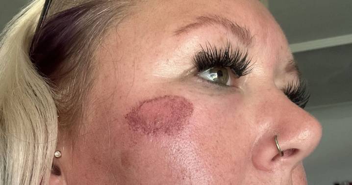 Mum injured on birthday night out after drink spiked when she left it