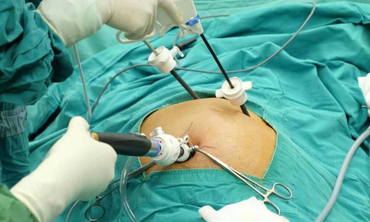 Machine Learning May Predict Postoperative Complications after Laparoscopic Cholecystectomy: Review...