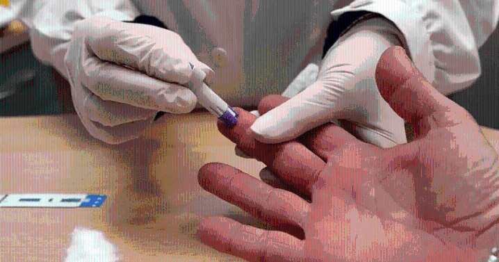 Día Mundial del Sida: «El tratamiento cambia el pronóstico de vida»