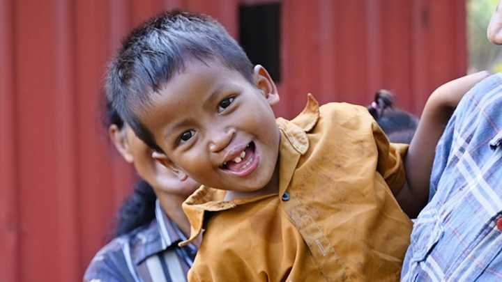 Four-Year-Old Faces a Life of Ridicule