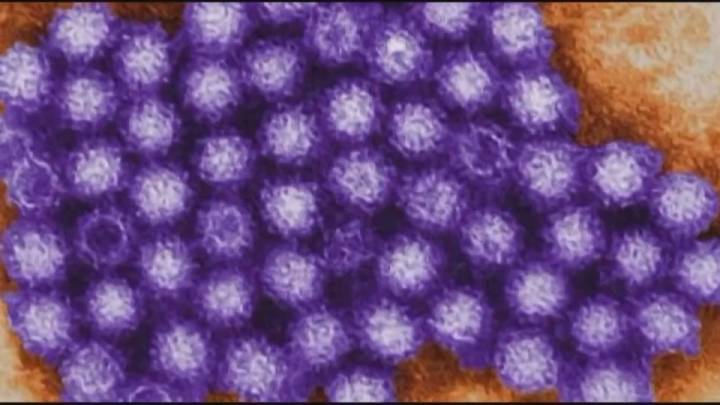 Norovirus spreading in Midwest, Illinois. Symptoms and what to know