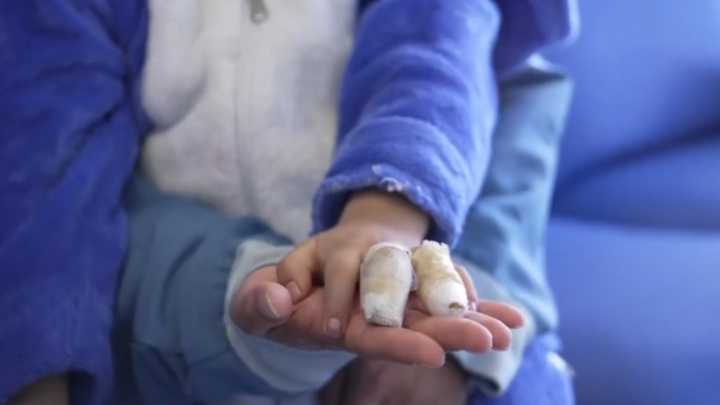 ‘¿Esperan que un hijo pierda un ojo?’: Fico Gutiérrez hace un llamado a los padres por quemaduras con pólvora