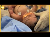 'Medical miracle:' Doctors deliver baby while removing 22