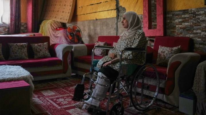 Alrededor de 6 mil personas perdieron una extremidad por la guerra en Gaza: OMS