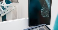 A New Way to Screen for Breast Cancer