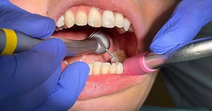 Japanese scientists making quieter dental drills to reduce anxiety
