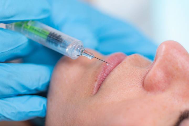 Complicaciones de rellenos dérmicos: riesgo de oclusión vascular