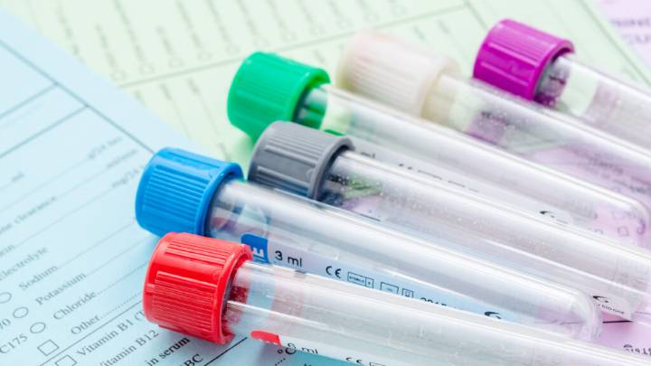 Freenome, cancer detection firm, plans to go public