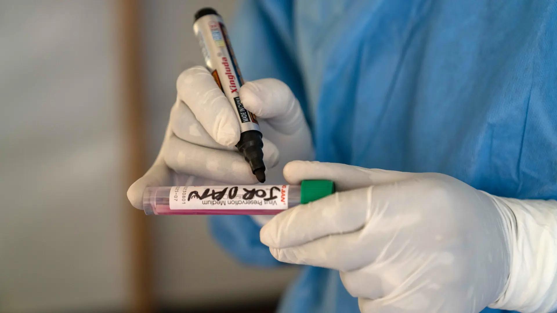 Identifican una nueva cepa de viruela del mono en Inglaterra