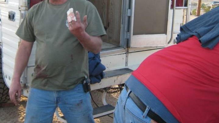 Mennonite Man Severely Injures Knipsing Finger