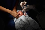 En Cholula, uno de 3 equipos para salvar la visión de recién nacido